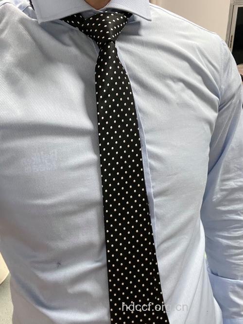 男士领带过紧易致眼睛疲劳