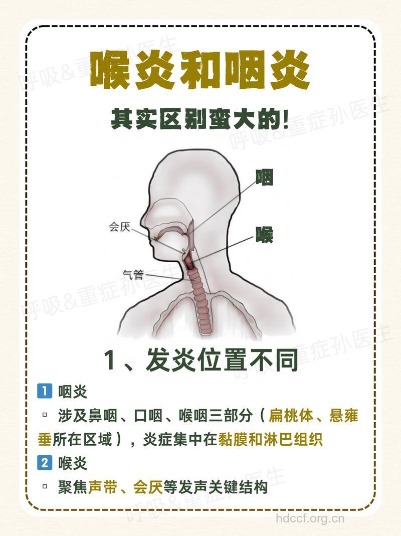 为什么会得咽喉炎