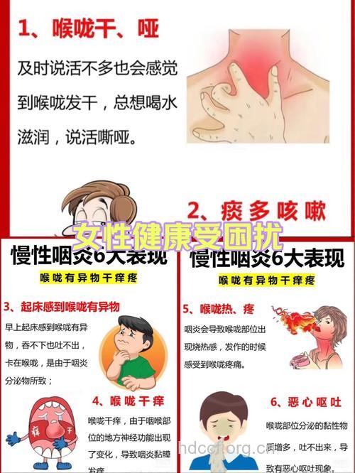 慢性咽炎发作的四大症状