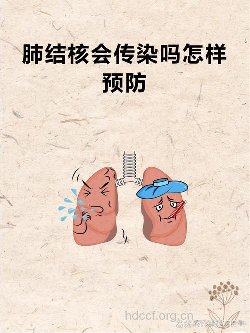 唾沫会传染肺结核吗 肺结核如何预防