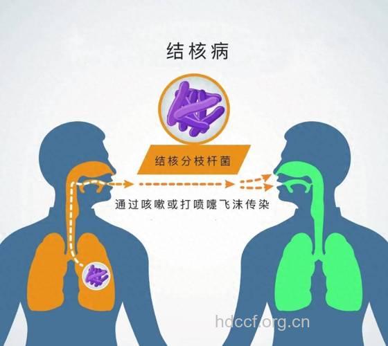 肺结核的三大传染途径