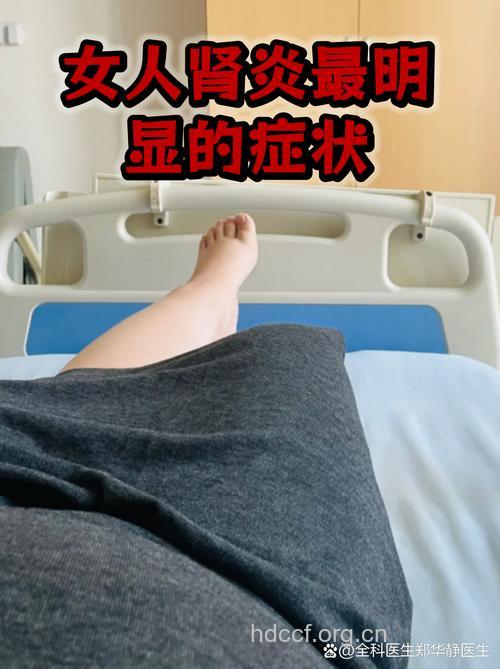 女性得了肾炎后有哪些表现呢