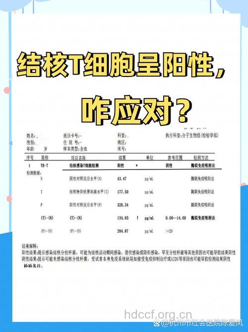 肺结核有什么诊断标准