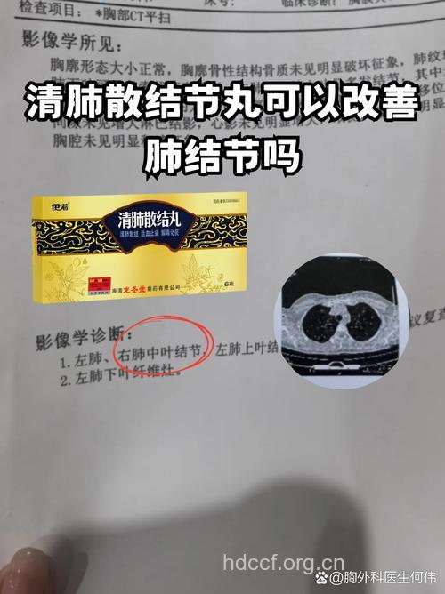 哪些药物可治疗肺结核