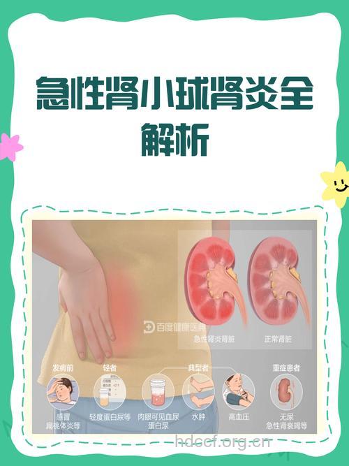 急性肾小球肾炎是怎么来的