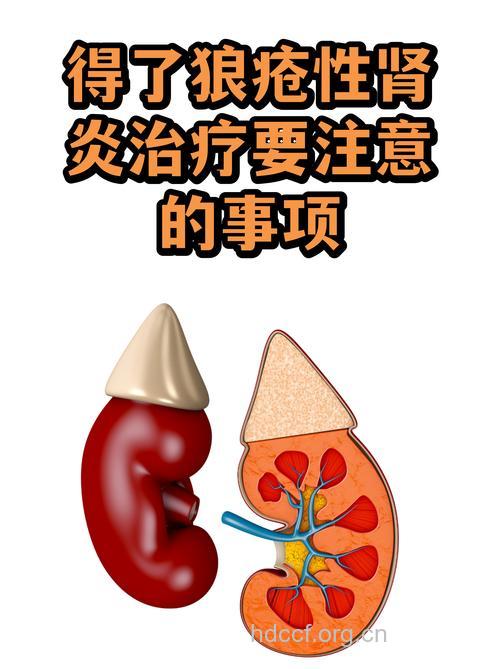 治疗狼疮性肾炎前有哪些关键点