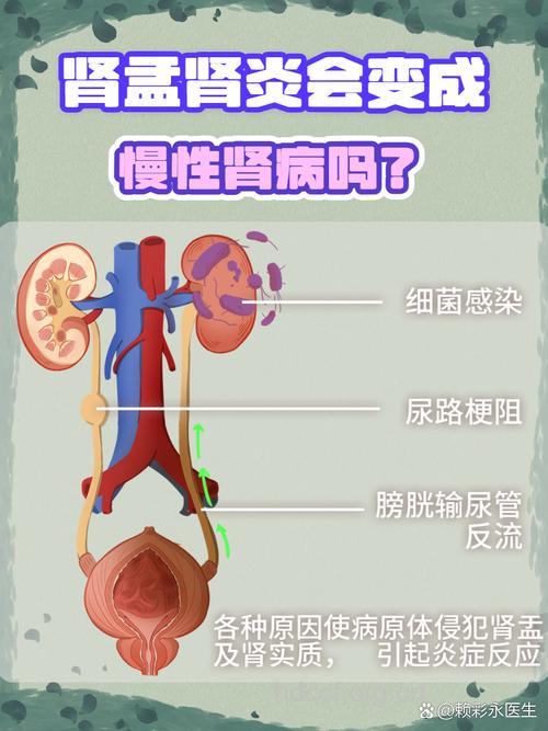 急性肾盂肾炎为什么会转成慢性