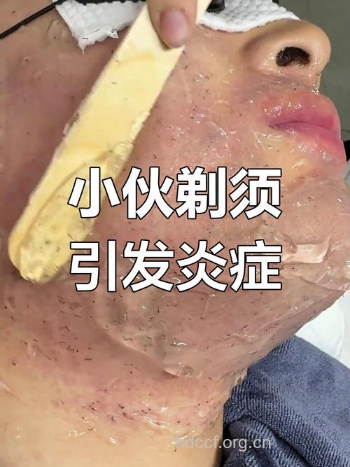 刮胡子时感觉疼痛也是一种病