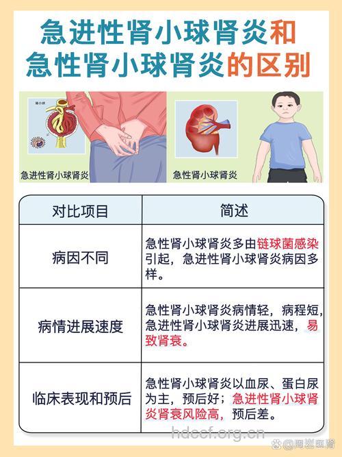 怎么认识急进性肾炎