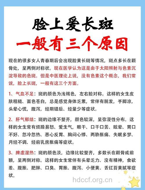 男性长斑的原因是什么 男士护肤攻略大全
