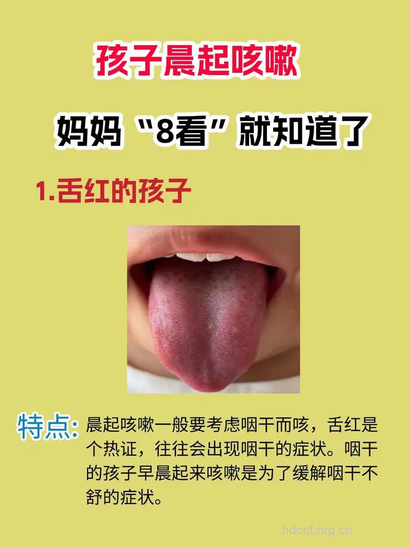 妈妈们注意啦！小儿感冒看舌像比把脉准