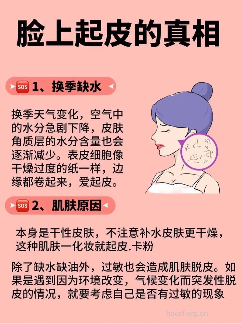 夏天脸部皮肤干燥怎么办