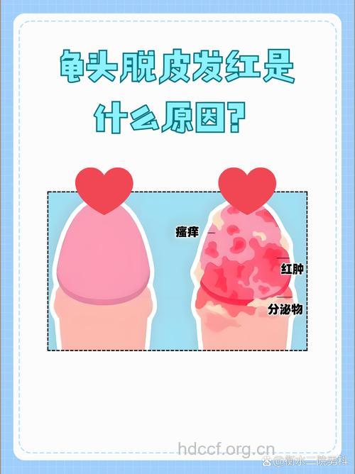 5大坏习惯最容易伤害男性皮肤