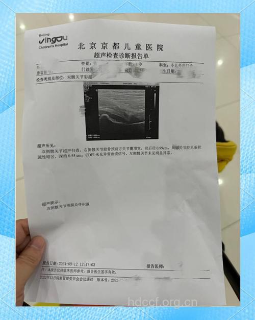 小儿感冒后腿痛可能是滑膜炎