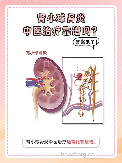 怎么诊治隐匿性肾小球肾炎方法