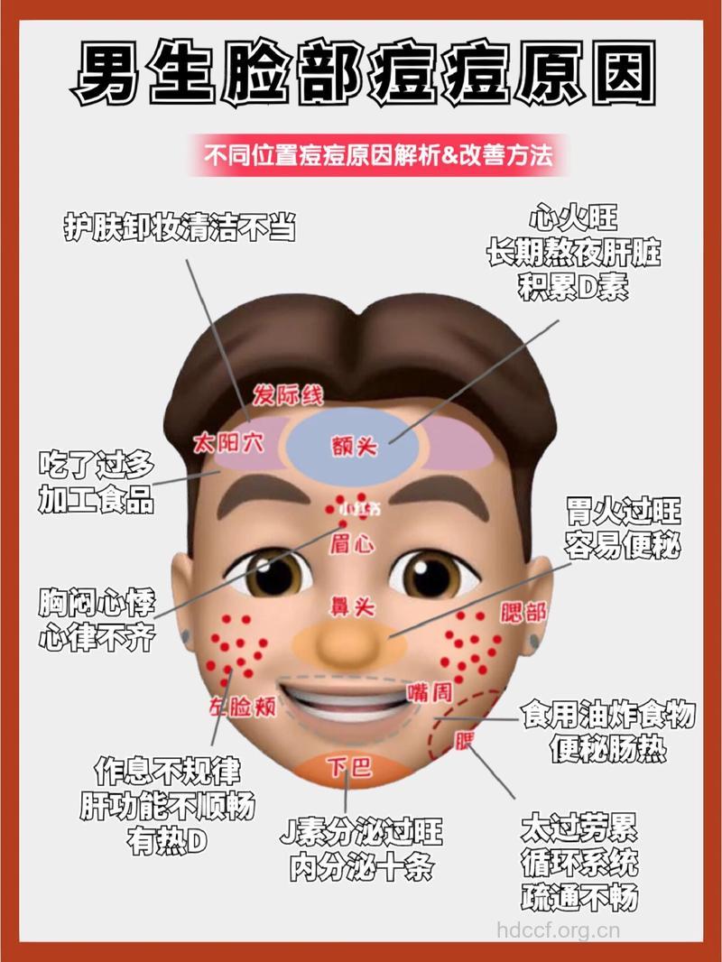 这5个因素让男性脸上长满痘痘