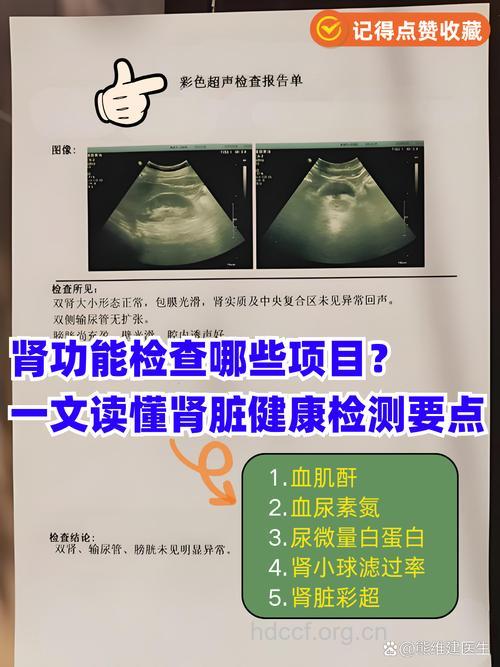 肾盂肾炎要做哪些常规检查