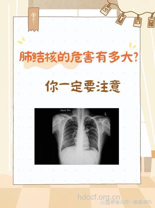 恶性肿瘤会并发肺结核