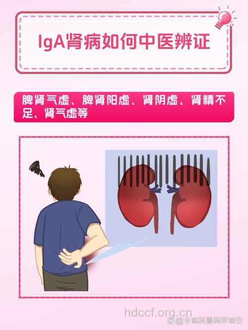 iga肾病怎么辩证治疗方法