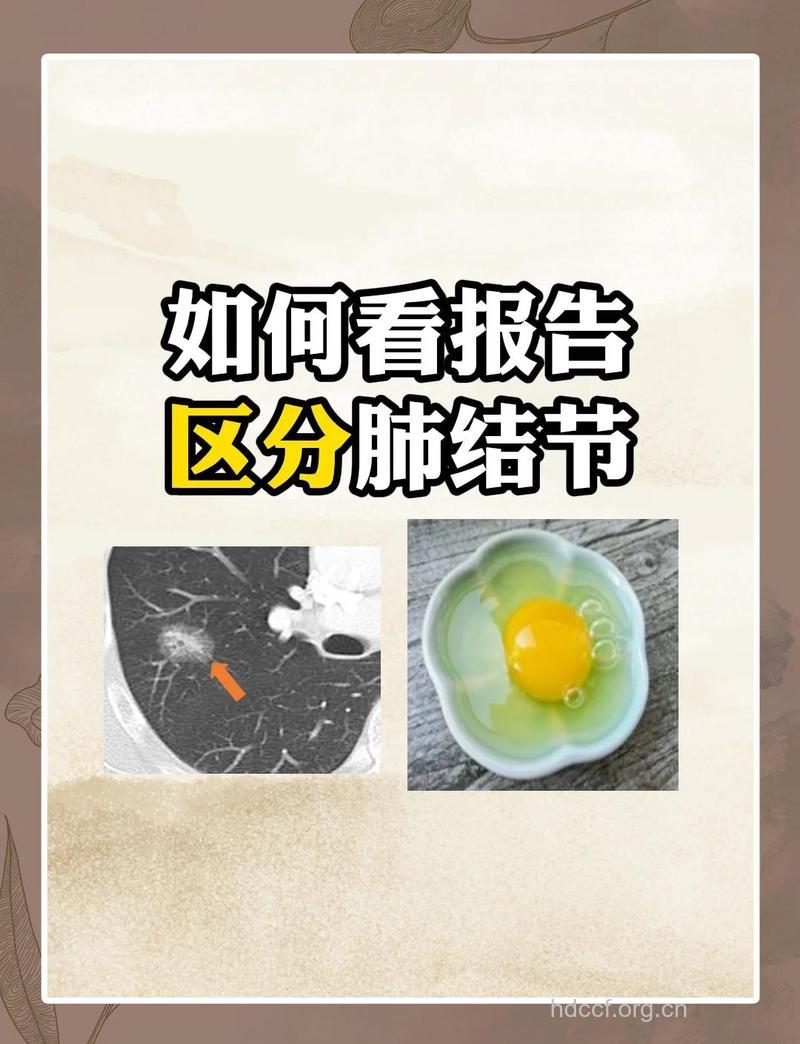 非典与肺结核的区别