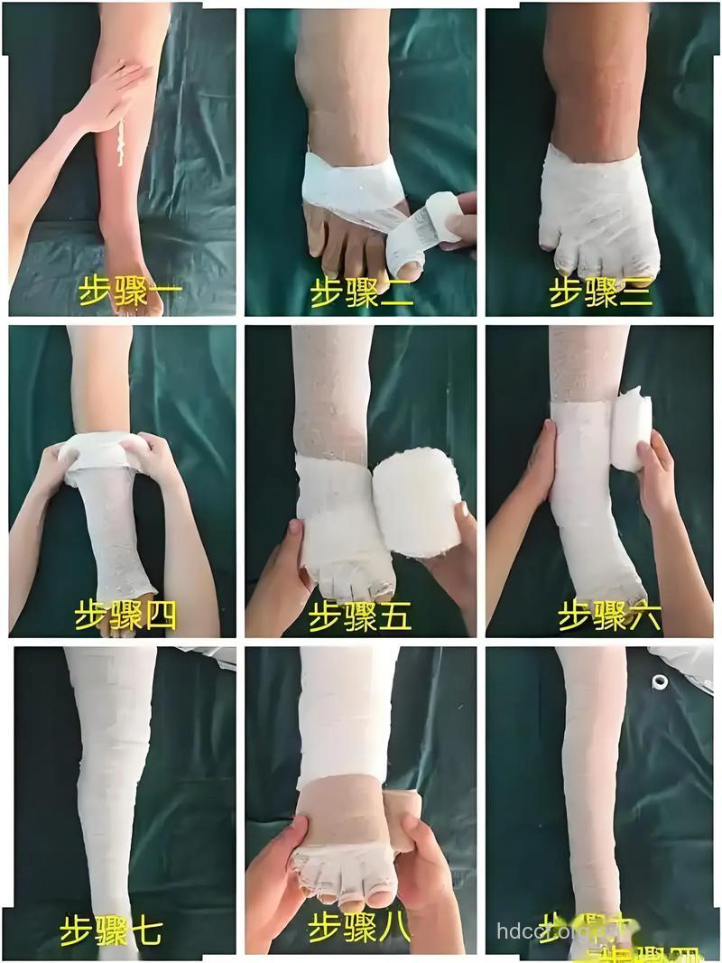 如何做好淋巴水肿的心理护理