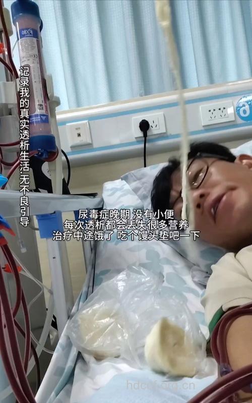 尿毒症,IgA肾病的残酷现实!