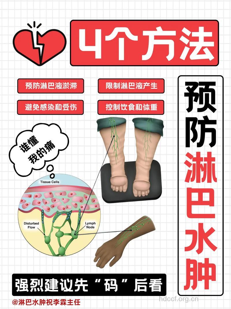 怎么避免出现淋巴水肿