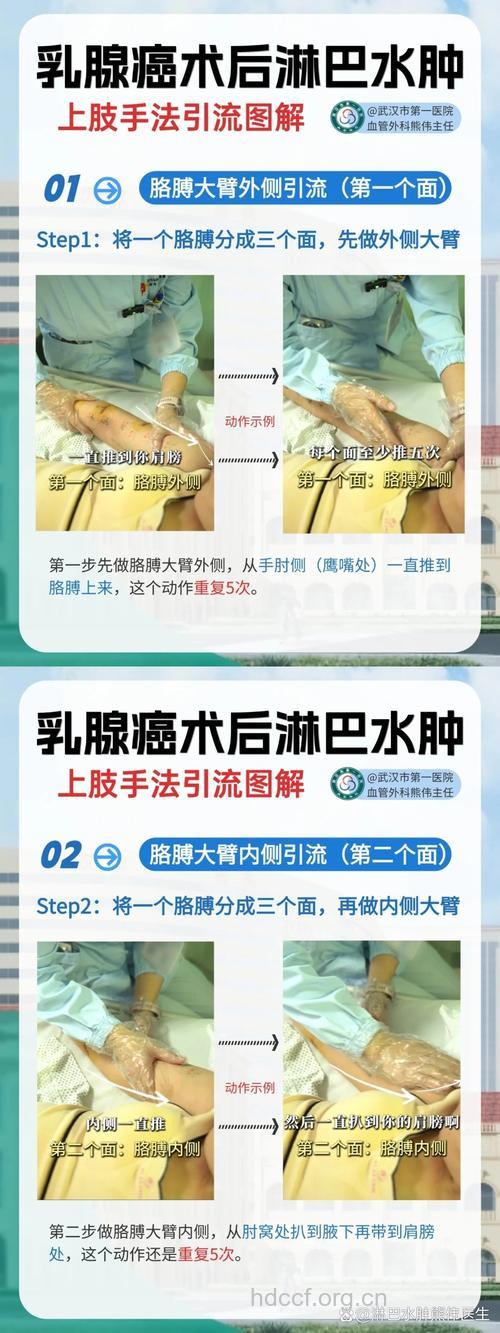 怎么防止乳腺癌术后出现淋巴水肿