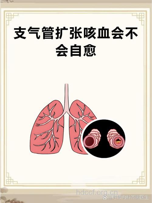 健康大作战 预防小儿支气管扩张