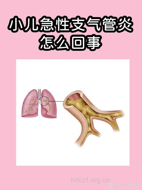 导致小儿支气管炎的病因
