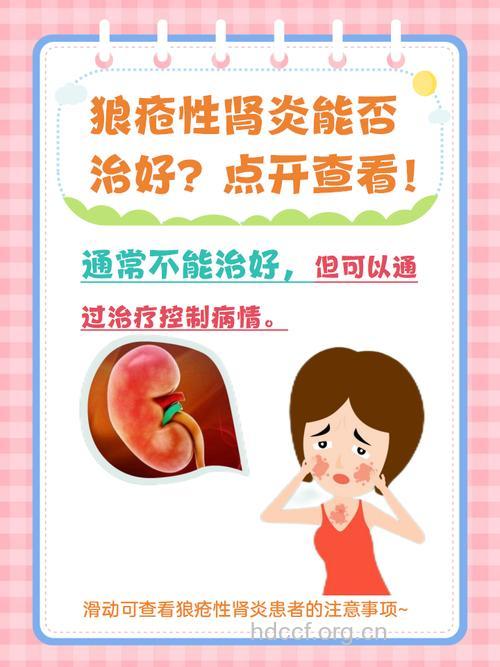 狼疮性肾炎 如何有效控制？