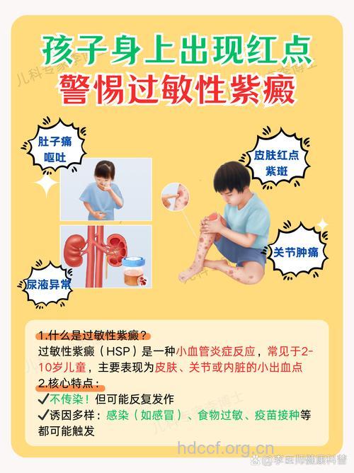 警惕小儿过敏性紫癜肾炎发生