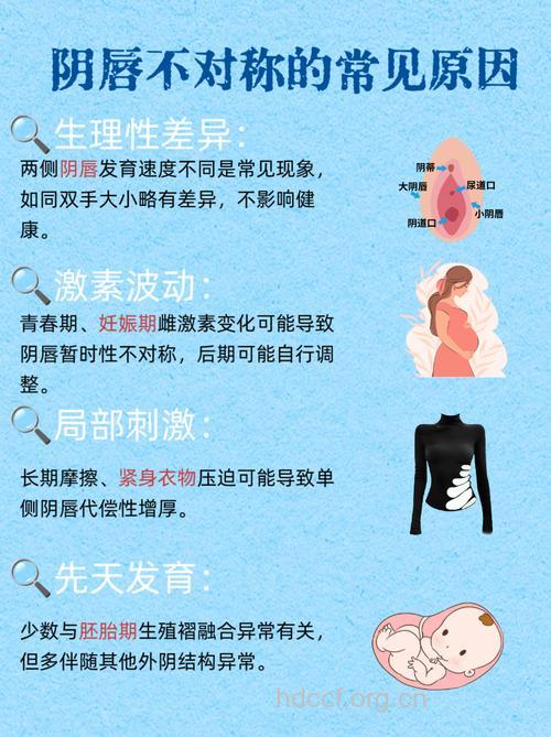 女性四类性发育异常疾病