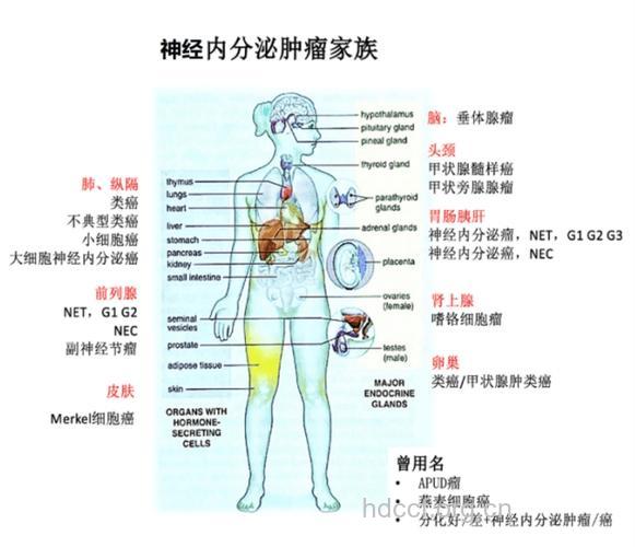 神经内分泌肿瘤变化多样