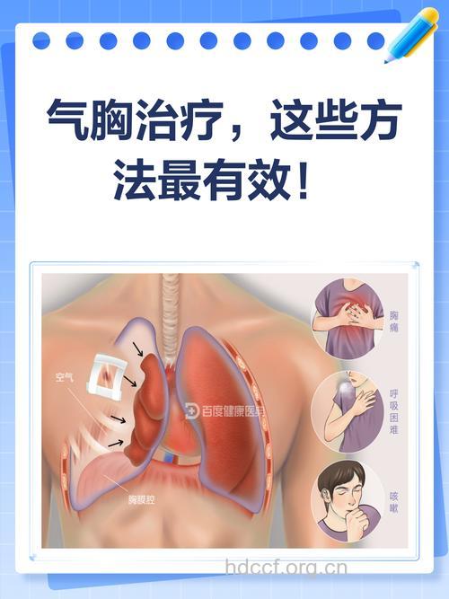 得了气胸该怎么治疗