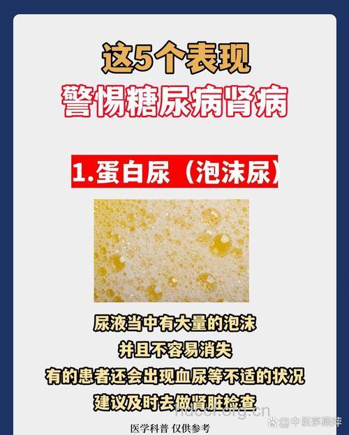 蛋白尿的具体危害有哪些