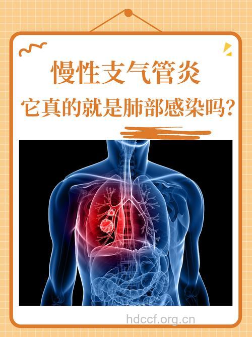 哪些情况慢性支气管炎最会找上你?