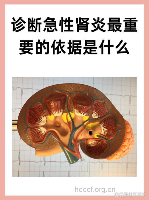 如何诊断急性肾炎