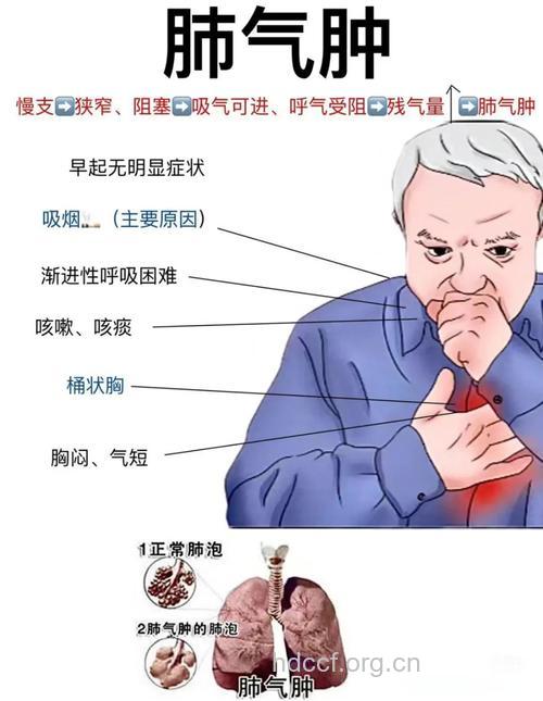 老年性肺气肿的表现