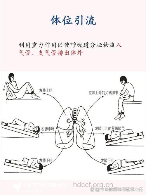 支气管扩张该怎么去治疗