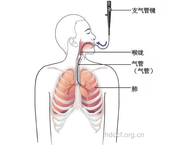 支气管扩张有什么检查手段