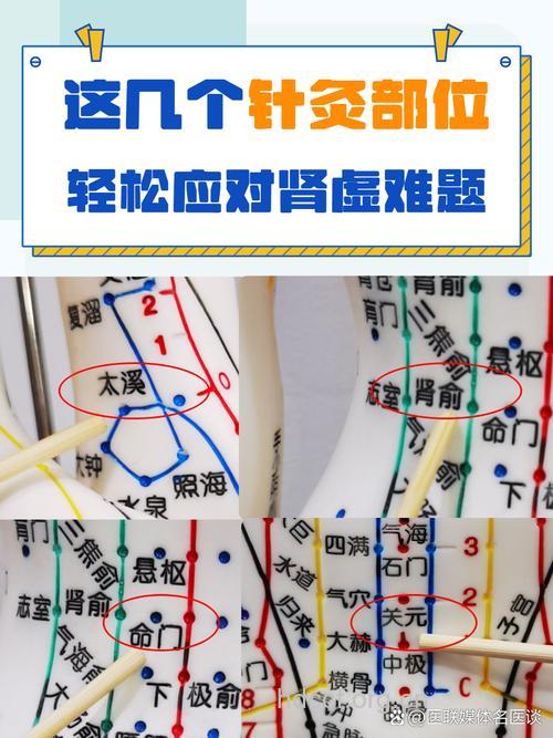 针灸法调养肾炎