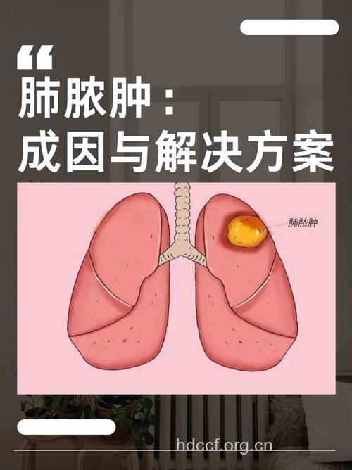 怎么全面认识肺脓肿