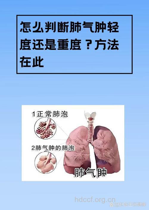 残气量多少是肺气肿呢