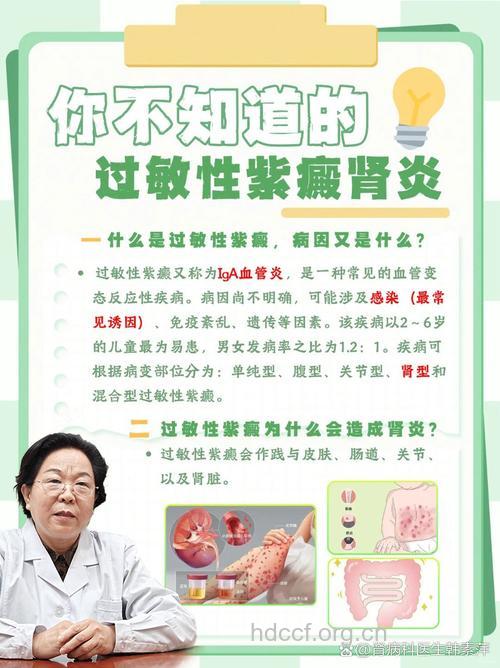 警惕过敏性紫癜肾炎的危害