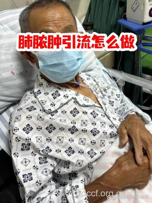 治疗肺脓肿的方法