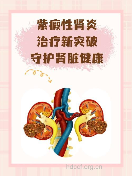 新发现：中医可治疗紫癜性肾炎