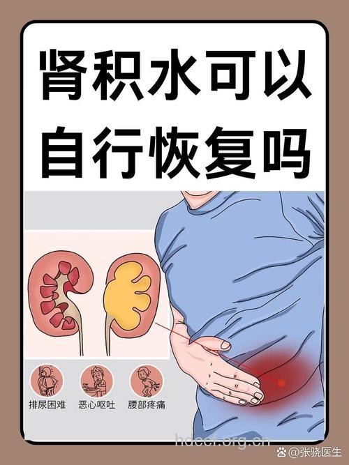 推荐两种治疗轻度肾积水的方法