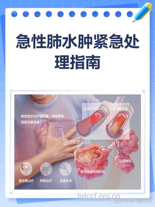 复张性肺水肿怎么治疗