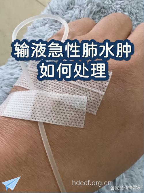 输液过快会导致肺水肿